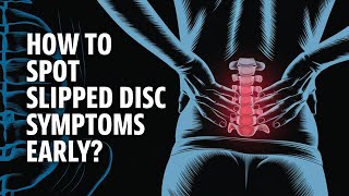 Slipped Disc Symptoms You Shouldn’t Ignore [upl. by Aicirtal]