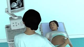 The Basic Steps of an Obstetric Ultrasound Examination [upl. by Ailen945]