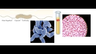 Campylobacter jejuni Part 1 Introduction Biochemical Properties and Virulence factors [upl. by Kirshbaum]