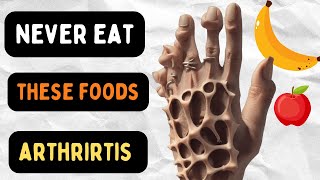 Never Eat These 7 Foods If You Have Arthritis [upl. by Euphemie]