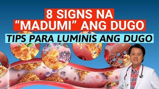 8 Signs na quotMadumiquot ang Dugo Tips Para Luminis ang Dugo  By Doc Willie Ong [upl. by Lokin]