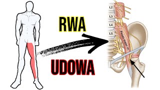 RWA UDOWA  ból pleców i drętwienie nogi  Ćwiczenia  ciekawostka 🧐 [upl. by Breech]