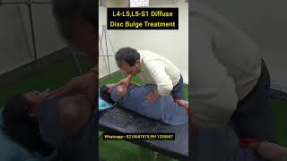 L4L5L5S1 Diffuse Disc Bulge Treatment l4l5l5s1discbulgetreatment L4L5discbulge youtubeshorts [upl. by Hareehat648]