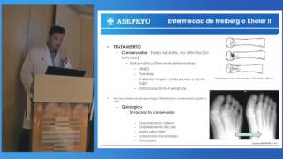 Osteocondritis y osteocondrosis [upl. by Werdnaed]