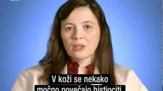 Skrivnostna diagnoza  sindrom HermanskyPudlak in Multicentrična retikulohistiocitoza 33 [upl. by Nirrac100]