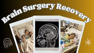 2 weeks after Craniotomy Surgery Recovery Update [upl. by Quickel]