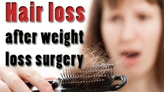 Hair loss after weight loss surgery [upl. by Edwina]