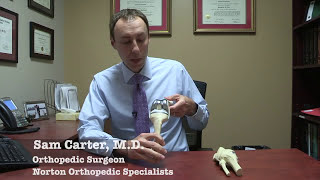 What is a partial knee replacement [upl. by Anatsirhc461]