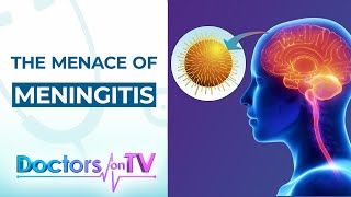 Meningitis Causes Symptoms and Treatment [upl. by Irisa]