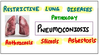 Restrictive Lung Diseases PNEUMOCONIOSIS Anthracosis  Silicosis  Asbestosis pathology robbins [upl. by Morel19]