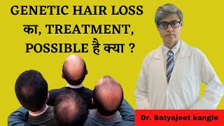 Genetic Hair Loss Treatment  Dr Satyajeet Kangle [upl. by Htebazil]