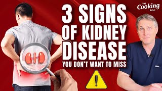 3 Signs of Kidney Disease You Dont Want to Miss [upl. by Shane683]