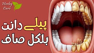 Top Effective Home Remedy to Remove Plaque and Tarter  Get rid of Dental Plaque at Home [upl. by Luapnoj4]