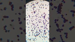 Micrococcus in urine culture culture microbiology bacteria gramstaining [upl. by Ipoillak65]