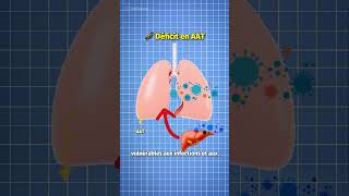 Déficit alpha 1 antitrypsine  Foie amp Poumons en danger [upl. by Rennoc]