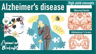 Alzheimers disease  Amyloid Plaque Buildup Medical Animation by Microcosm Medical Animation [upl. by Eenrahc]