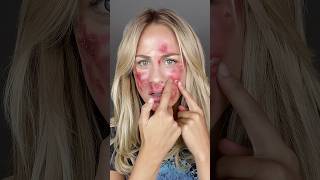 MRSA viralvideo creepy makeup makeuptransformation scary [upl. by Malina]