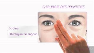 Chirurgie des paupières  Blépharoplastie [upl. by Sacrod]