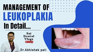 MANAGEMENT OF LEUKOPLAKIA IN DETAIL [upl. by Noterb783]