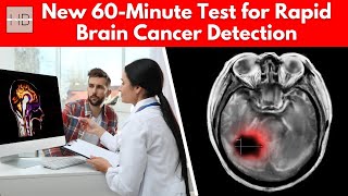 This Blood Test Reveals Deadly Brain Cancer in Just 60 Minutes [upl. by Reed]