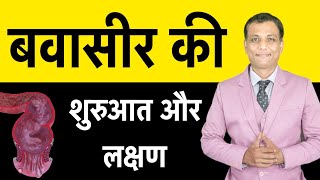 बवासीर कैसे बनता है  बवासीर होने की शुरुआत और लक्षण  Piles Symptoms  Dr Deepak [upl. by Ramberg]