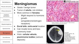 Nervous System Tumors [upl. by Justicz]