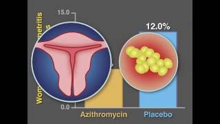 PostCesarean Infection and Antibiotic Prophylaxis  NEJM [upl. by Alain169]