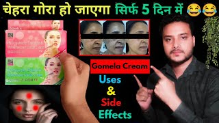 Gomela skin creamuses amp side effects full review in hindiGomela forte creamClin skin cream [upl. by Marx]