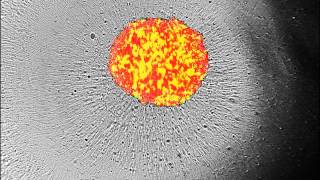 JuLI Stage Application Video 3D Spheroid Cell Culture images for 72 hours [upl. by Anilocin]