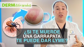 ¿Cuál es la enfermedad de Lyme [upl. by Zetroc500]