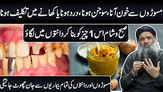 Gum Bleeding Treatment at Home  Danto Se Khoon Aana  Masoro Se Khoon Aane Ka ilaj Dr Sharafat Ali [upl. by Aremmat499]