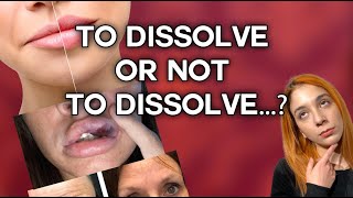 Should I Dissolve My Filler  WHAT TO EXPECT amp COMMON MISCONCEPTIONS [upl. by Nekal]