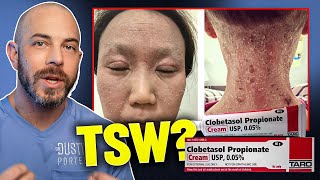 Is Topical Steroid Withdrawal Real Dermatologist Answers TSW [upl. by Suilenrac]