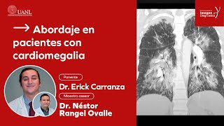 Abordaje en pacientes con cardiomegalia por el Dr Erick Carranza [upl. by Eitteb]