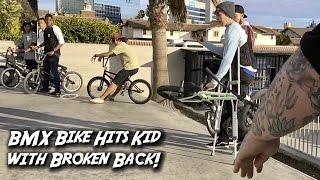 HIS BIKE HIT A GUY WITH A BROKEN BACK [upl. by Atekan902]