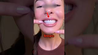 How To Get White Teeth 😨 [upl. by Douglass400]