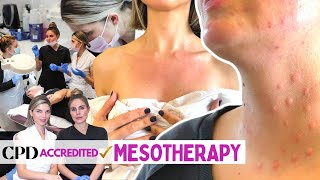 Introduction To Our New Mesotherapy Course  Everything You Need To Know Microneedling Skin Care [upl. by Aved521]