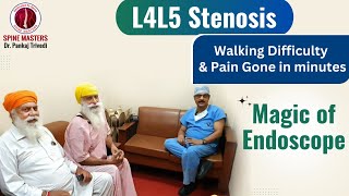 L4L5 Stenosis  Walking Difficulty amp Pain Gone in Minutes  Magic of Endoscope  Spine Masters [upl. by Enoval]