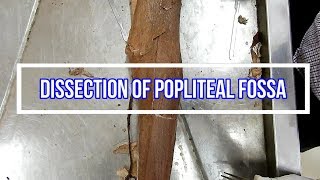 Dissection of Popliteal Fossa [upl. by Nollad]