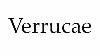 How to Pronounce Verrucae [upl. by Ifok473]