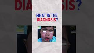 Paediatric Exam Spot Diagnosis 2 l 3 year old boy l mrcpch usmle medicalschool [upl. by Bordiuk]