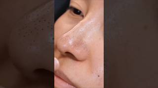 Remove nose blackheads easily at homeviralvideo blackheads shorts [upl. by Marco]