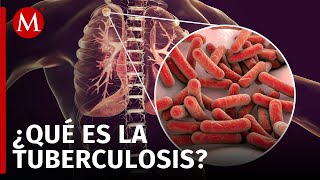 ONU busca erradicar tuberculosis para el 2030 hay más de 10 millones de casos al año [upl. by Daryle]