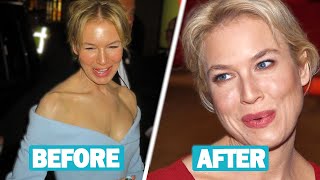 Renée Zellweger Plastic Surgery and Weight Loss Journey [upl. by Denis252]