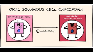 Animated Histology Colon Cancer Progression [upl. by Einnim]