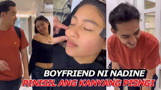 NADINE LUSTRE PINISIL NG BOYFRIEND ANG KANYANG PISNGI  DINALA ANG BF SA AIVEECLINIC [upl. by Zetrok]