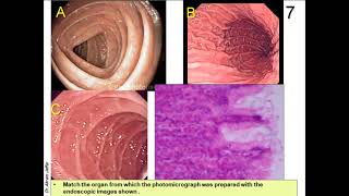 OSPE in Anatomy of Gastrointestinal and Renal Systems [upl. by Inaboy]