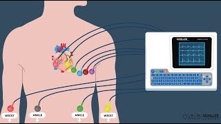 SCHILLER ECG Electrocardiogram Basics [upl. by Khudari]