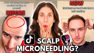 Can You Grow Back Hair With Scalp Microneedling Does Scalp Microneedling Work [upl. by Nirok383]