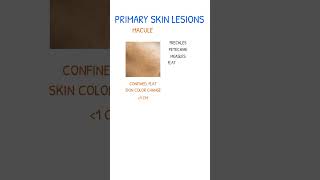 SKIN LESIONS Macule vs Papule [upl. by Becki]